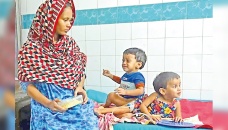 Bangladesh surgeons to separate conjoined twin girls 