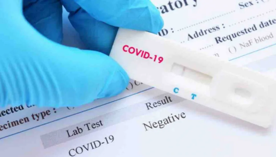 Covid-19 test fees reduced at private labs