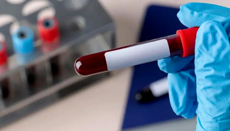 EMM negative: Rare blood type discovered in Indian man