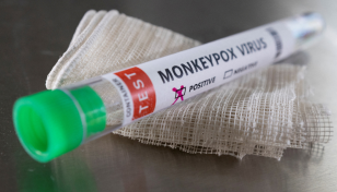 'Very ignorant rumour': Misinformation abounds about monkeypox