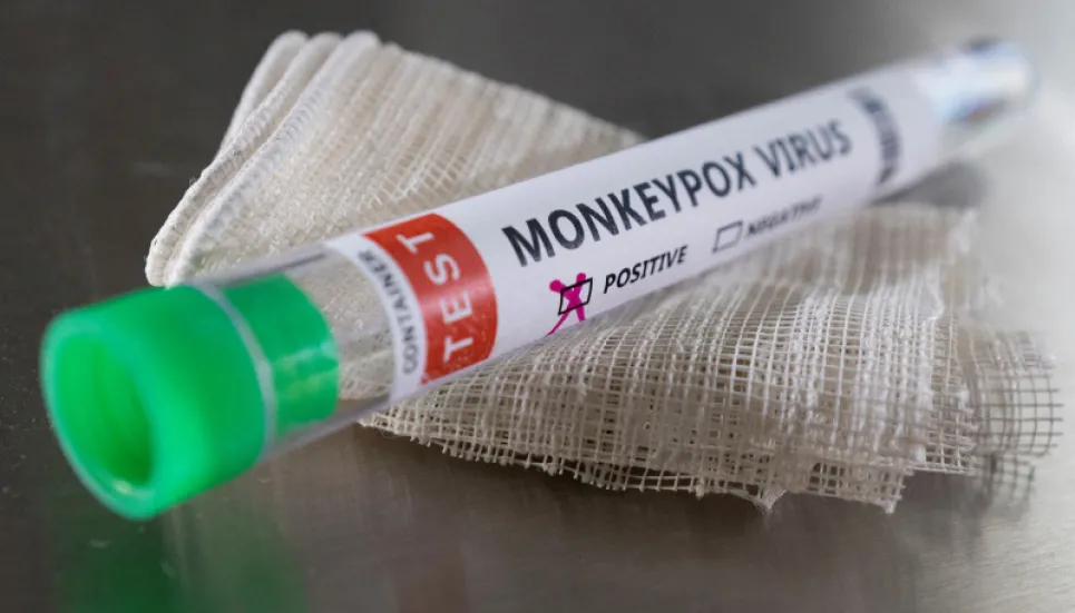 Health agency confirms community spread of monkeypox in England