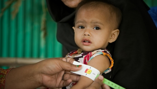 UNICEF: South Asia epicentre of severely malnourished children