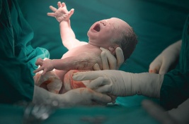 Doctors deliver baby carried outside abdomen