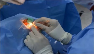 US surgeons perform world's first whole eye transplant