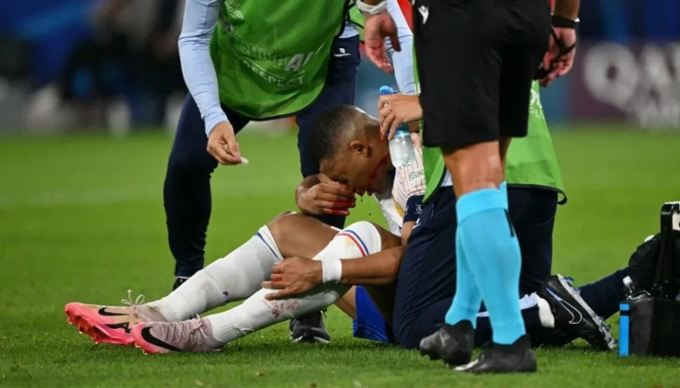 Mbappe breaks nose in France Euro 2024 win