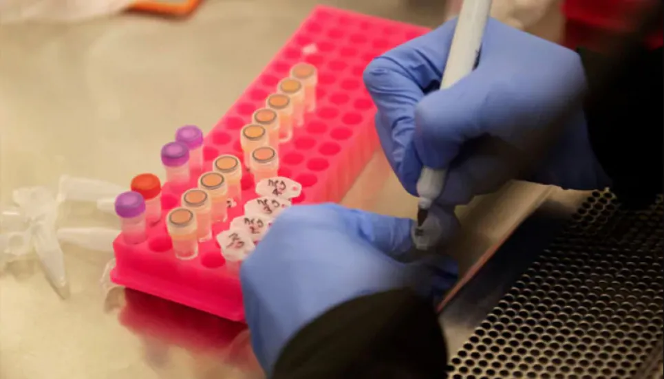 New method to detect coronavirus 'in 40 mins', claim DU researchers